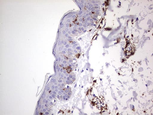 TACC2 Antibody (aa727-1026, clone OTI3C4)