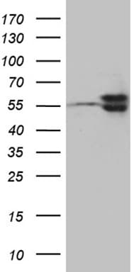 TBL1XR1 / TBLR1 Antibody (clone OTI2A8, Carrier-free)