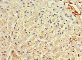 ARG1 / Arginase 1 Antibody (aa1-322)
