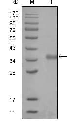 Monoclonal Mouse anti-Human N-CoR / NCOR1 Antibody (clone 7A7A9, IHC, WB)