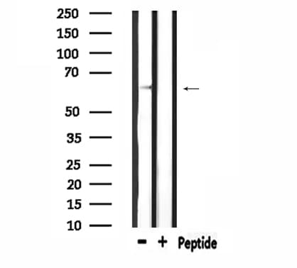 SLC6A1 / GAT-1 Antibody