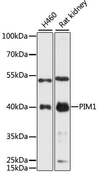 PIM1 / Pim-1 Antibody