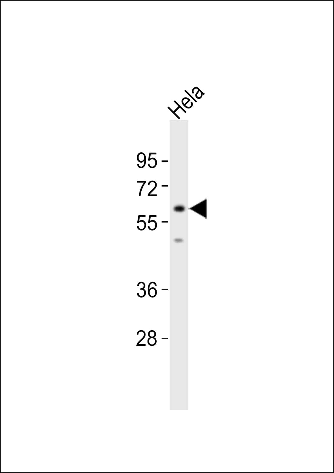 SRSF4 / SFRS4 Antibody