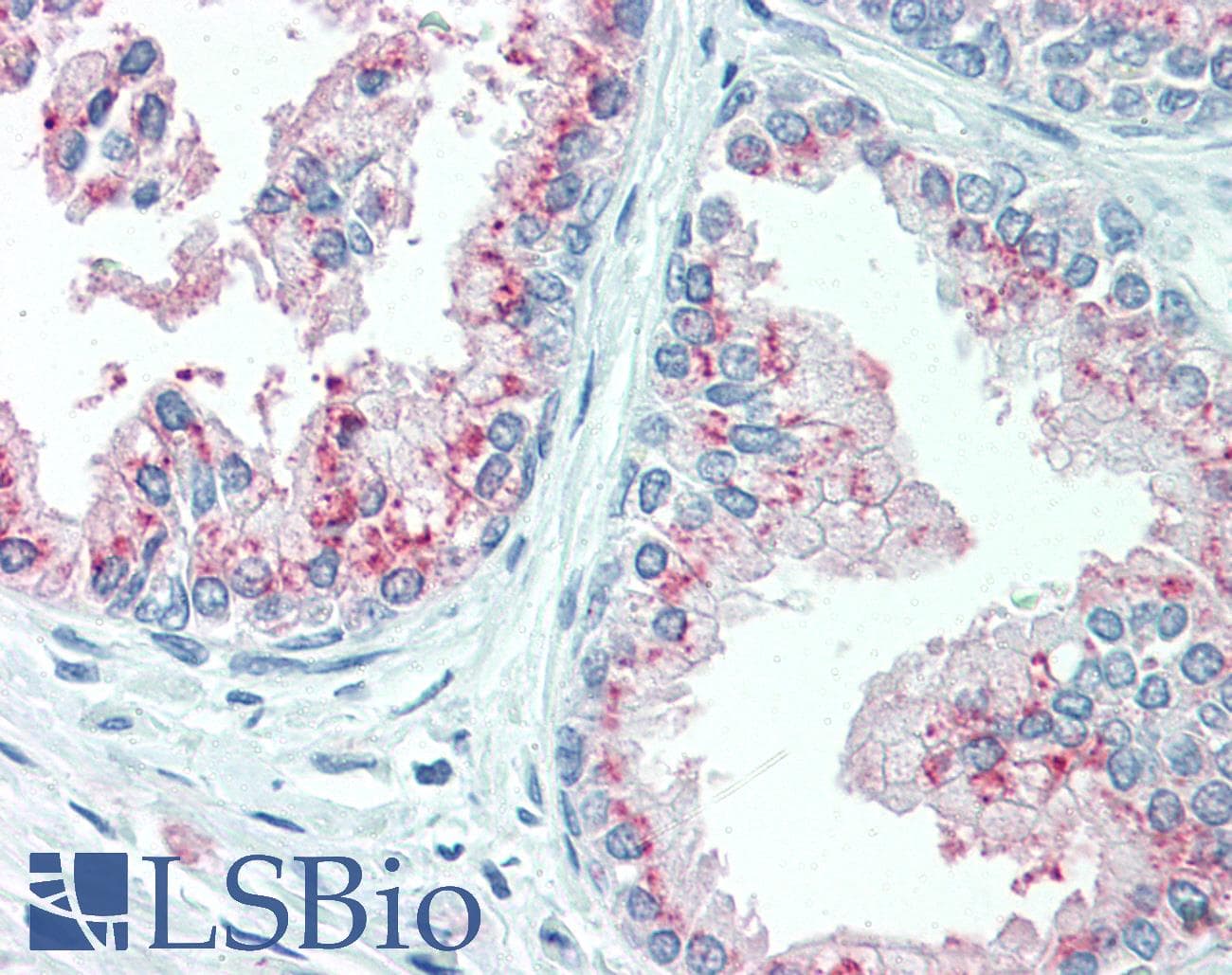 IHC-plus™ KIAA1324 / maba1 Antibody (N-Terminus)