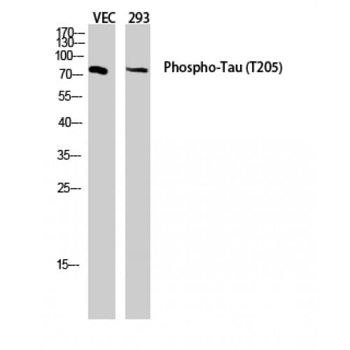 MAPT / Tau Antibody (460-540 aa)