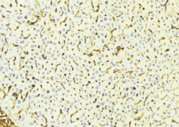 Polyclonal Rabbit anti-Human MAOA / Monoamine Oxidase Antibody (IHC, WB)