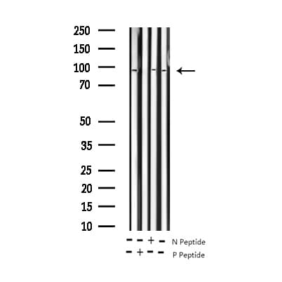 ATRIP Antibody (phospho-Ser68)