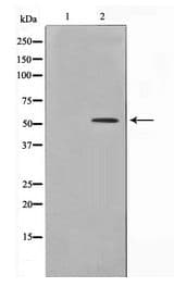 LYN Antibody