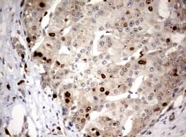 MKI67 / Ki67 Antibody (aa1160-1493, clone OTI5E6)