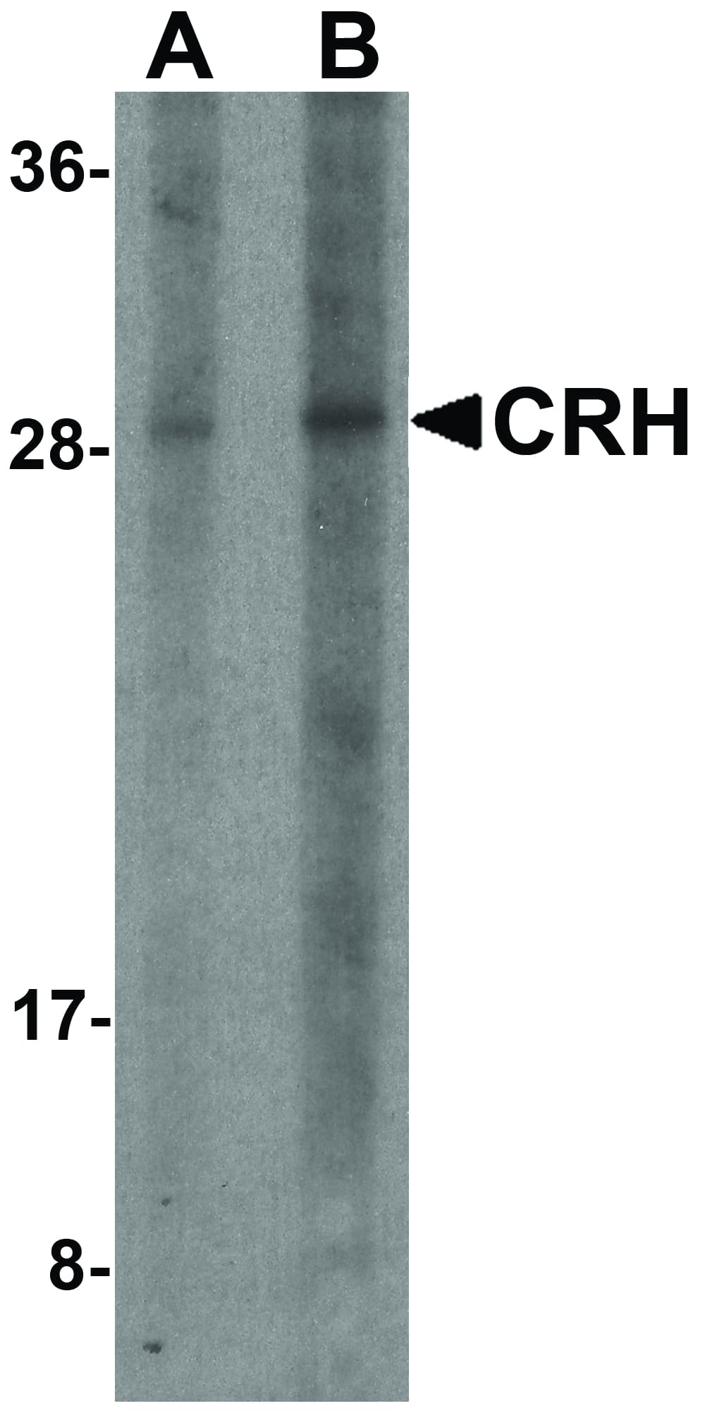 CRH / CRF Antibody