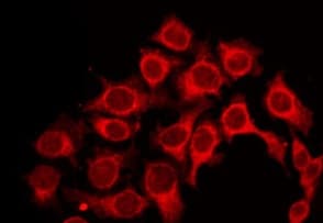 P2RY6 / P2Y6 Antibody