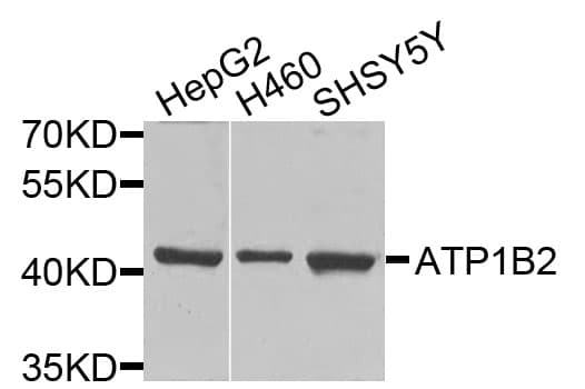 AMOG / ATP1B2 Antibody