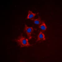 PathPlus™ KRT8 / CK8 / Cytokeratin 8 Antibody (C-Terminus)