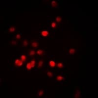 RORA / ROR Alpha Antibody