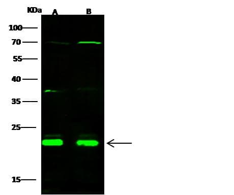 Polyclonal Rabbit anti-Human CBFB Antibody (Preservative Free, IF, WB)