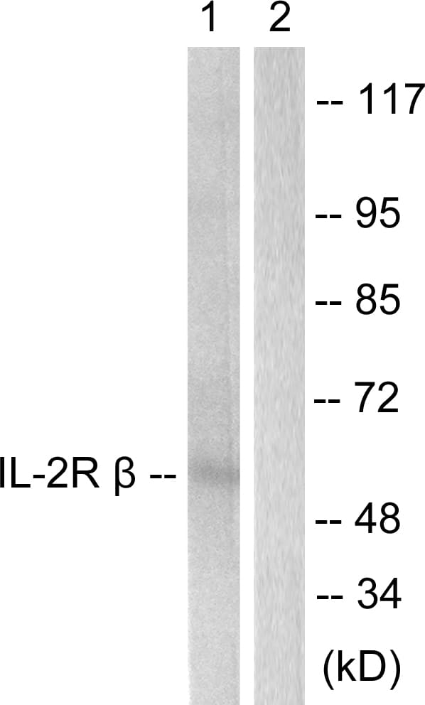 IL2RB / CD122 Antibody (aa331-380)