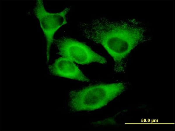 Monoclonal Mouse anti-Human EIF5 Antibody (clone 2E6-4C12, IHC, IF, WB)