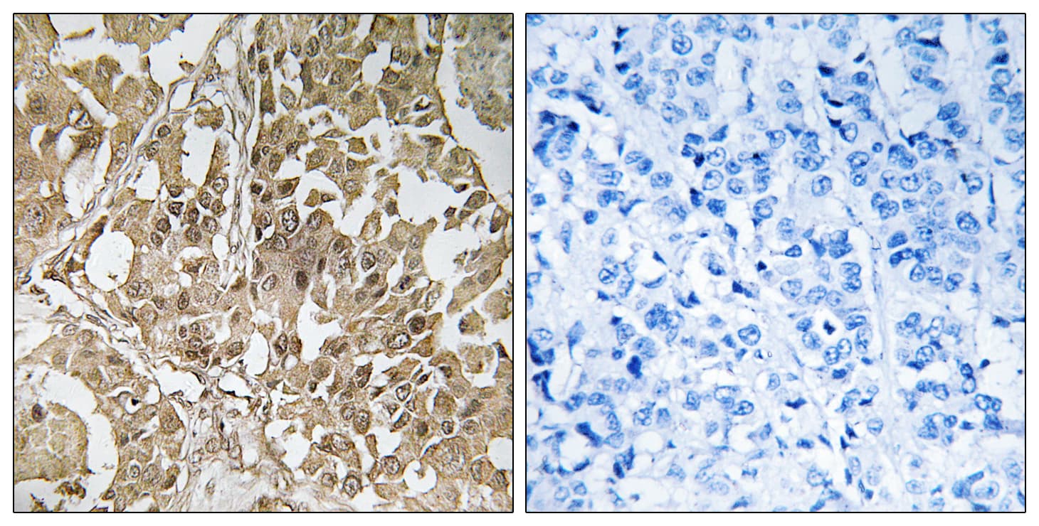 Polyclonal Rabbit anti-Human BUB1 Antibody (aa251-300, IHC)