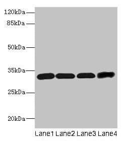 PathPlus™ CD20 Antibody