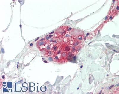 IHC-plus™ PVRL2 / CD112 Antibody