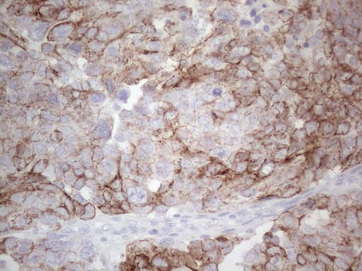 Monoclonal Mouse anti-Human KRT19 / CK19 / Cytokeratin 19 Antibody (clone UMAB188, Carrier-free, aa240-390, IHC, IF, WB)