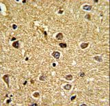 RCBTB2 Antibody (aa71-99)