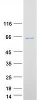 Human MTMR2 Protein (Recombinant Myc-DDK (Flag))