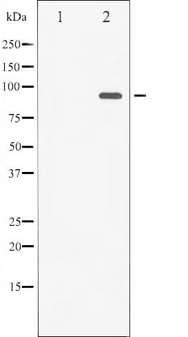 PR / Progesterone Receptor Antibody (phospho-Ser400)