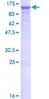 Human OGT / O-GLCNAC Protein (Recombinant GST)