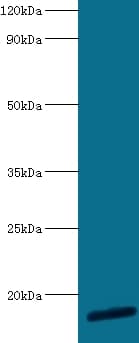 RPL30 / Ribosomal Protein L30 Antibody