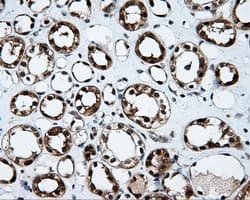 KIAA0153 / TTLL12 Antibody (clone OTI5H3)
