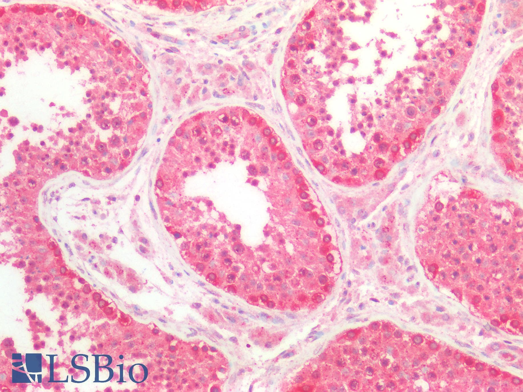 TREM2 / TREM-2 Antibody