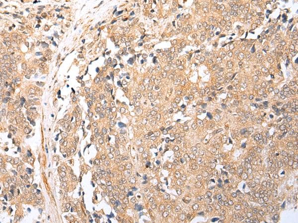 BAG2 Antibody