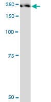 PLXNA2 / Plexin A2 Antibody (clone 2G5)
