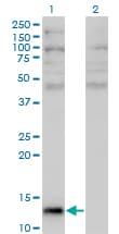Angiogenin / ANG Antibody (clone 2A7)