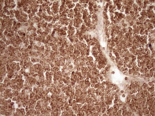 BCL2 / Bcl-2 Antibody (clone OTI9D3)