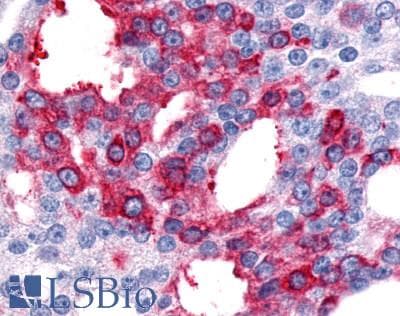 PathPlus™ Polyclonal Rabbit anti-Human CALCRL / CGRP Receptor Antibody (N-Terminus, IHC)