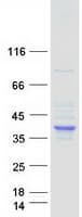 Human SDS Protein (Recombinant Myc-DDK (Flag))