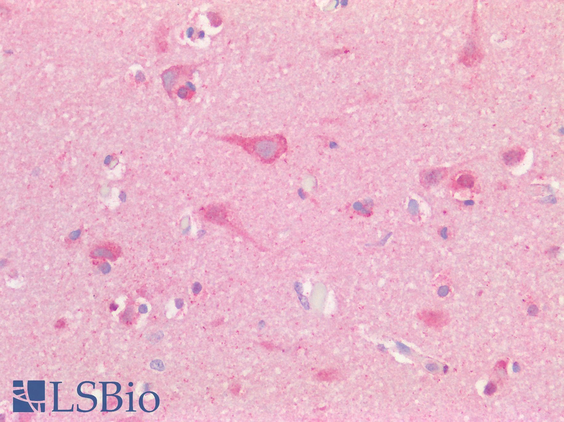 USP30 Antibody (aa141-190)