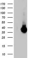 ARH / LDLRAP1 Antibody (clone OTI5A12)