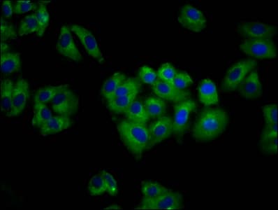 ANO6 Antibody