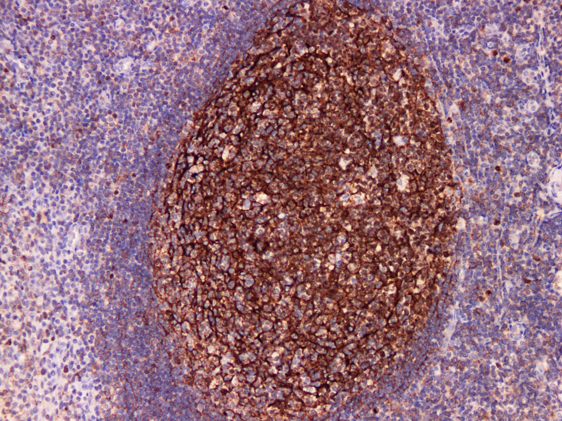 CR1 / CD35 Antibody