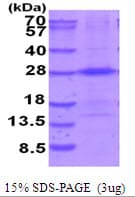 Human THOC7 Protein (Recombinant His)