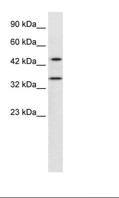 PNMA1 / MA1 Antibody (aa218-267, Biotin)