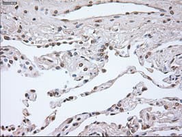 NOG / Noggin Antibody (clone OTI1H8)