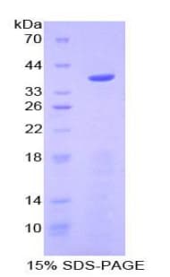 Mouse Apolipoprotein C-I (Recombinant His-GST)