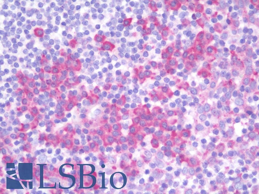 IHC-plus™ RAB38 Antibody (aa80-129)