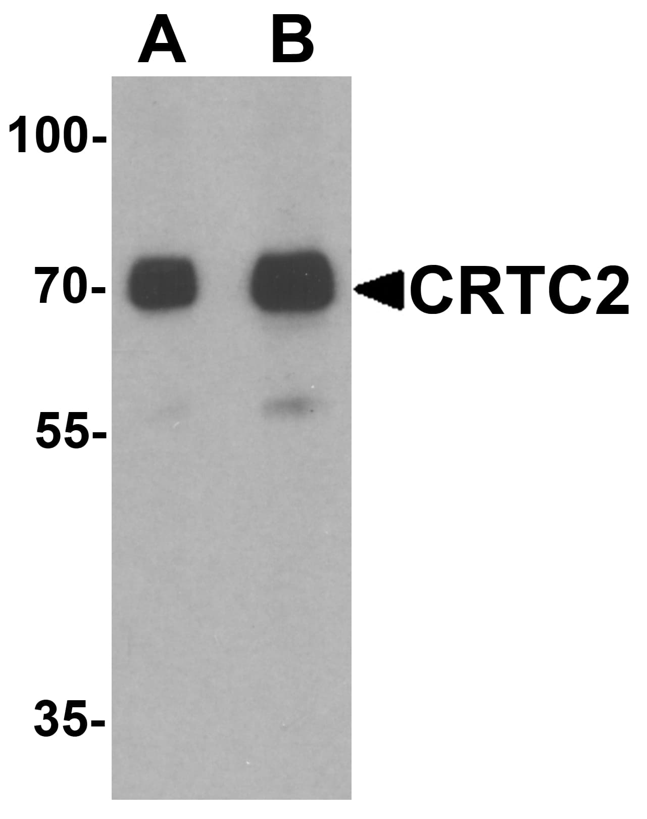 IHC-plus™ Polyclonal Rabbit anti-Human CRTC2 / TORC2 Antibody (IHC, IF, WB)