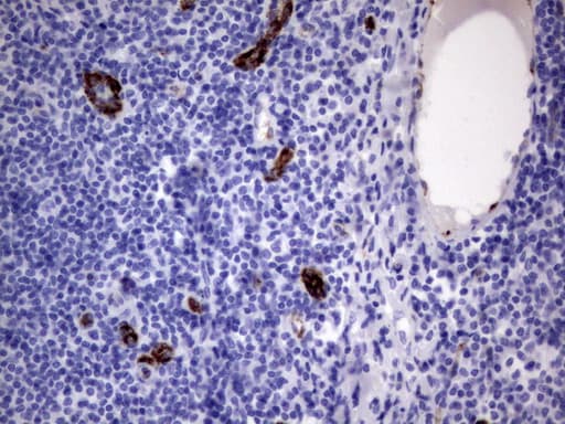 VWF / Von Willebrand Factor Antibody (aa764-1263, clone OTI9F3)