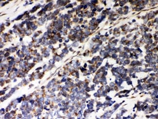 PRDX5 / Peroxiredoxin 5 Antibody